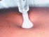 Picture of  S.I.T. SKIN INJECTION THERAPY 31G 0,26X2.5 mm - white, 25 pcs.
