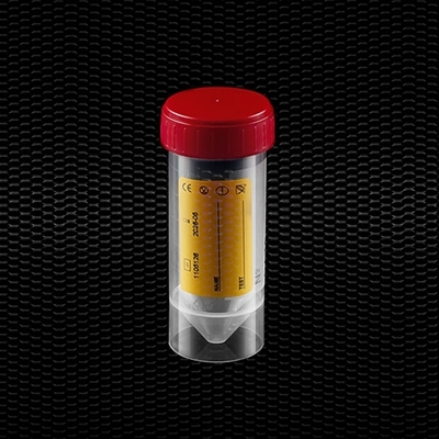 Picture of Caurspīdīgs polipropilēna urīna trauks 30 ml ar sarkanu skrūvējamu vāciņu un dzeltenu etiķeti 100gb