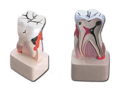 Picture of  DENTAL PATHOLOGY - 4X 1pcs