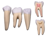 Vairāk informācijas par 3 zobu KOMPLEKTS : Priekšzobs, dzeroklisi, molārs - 5 daļas - 10X 1gab