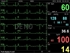 Picture of PC-3000 MULTI-PARAMETER PATIENT MONITOR