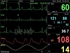 Picture of PC-3000 DAUDZP PARAMETRU PACIENTU MONITORS