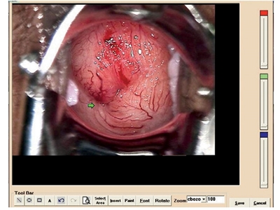 Picture of COLPOSCOPY SOFTWARE for 29620, 29624, 29600 with 29603, 1 pc.