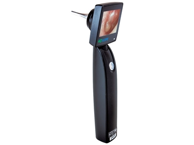 Picture of MD SCOPE VIDEO OTOSCOPE - DELUXE ZIPPER PACK 2 PROBES, 1 pc.