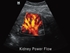 Picture of MINDRAY Z5 COLOUR ULTRASOUND with 2 probe connectors, 1 pc.