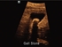 Picture of MINDRAY Z5 COLOUR ULTRASOUND with 2 probe connectors, 1 pc.