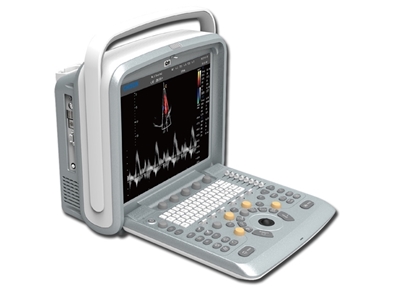 Picture of CHISON Q9 PORTABLE COLOURDOPPLER + 4D PROBE AND SOFTWARE, 1 pc.