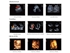 Picture of CHISON Q9 PORTABLE COLOURDOPPLER + 4D PROBE AND SOFTWARE, 1 pc.