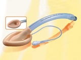 Show details for LARYNGEAL MASK 2 without holes - infant,  1 pc.