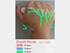 Picture of PROFESSIONAL VEIN SHOWING SYSTEM, 1 pcs.