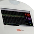Picture of F30 Fetal Monitor Standard (without twins function)