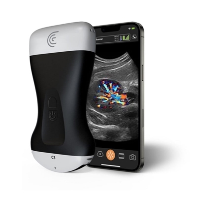 Picture of Clarius HD3 Ultrasound System C3 (2-6 MHz, 40 cm)