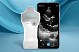 Show details for Vscan Air™ SL Ultrasound System