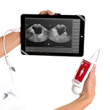 Show details for VitaScan v.2 Bladder Scanner Transducer (without Tablet)