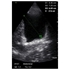 Picture of Vscan Extend™ Ultrasound System with sector transducer