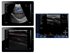 Picture of VIATOM DUAL HEAD LINEAR/CONVEX WIRELESS PORTABLE ULTRASOUND