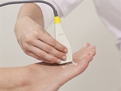 Picture of CR-PROBE for metatarsal for 56800 - optional need 56805