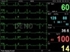 Picture of PC-3000 MULTI-PARAMETER PATIENT MONITOR